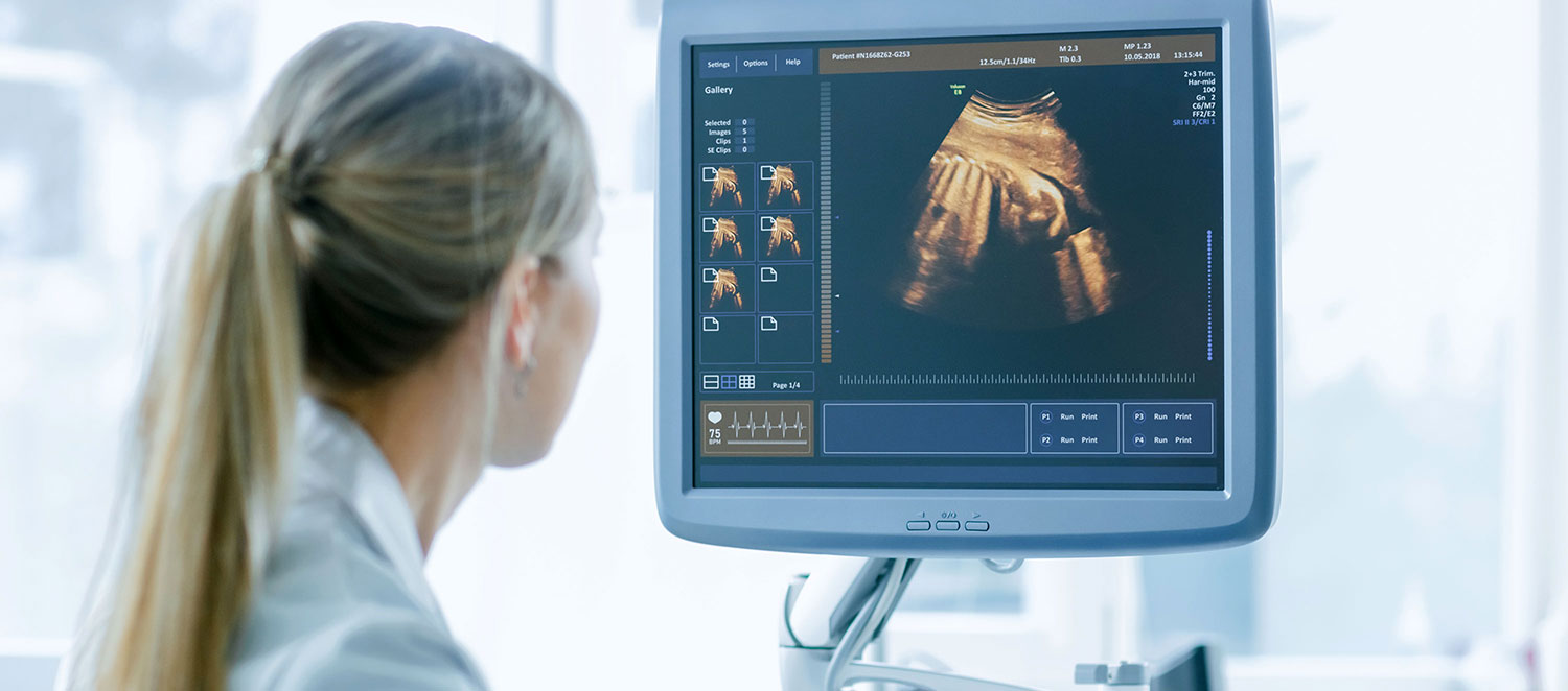 Medizinische Fachkraft vor Bildschirm mit Ultraschallbild. 